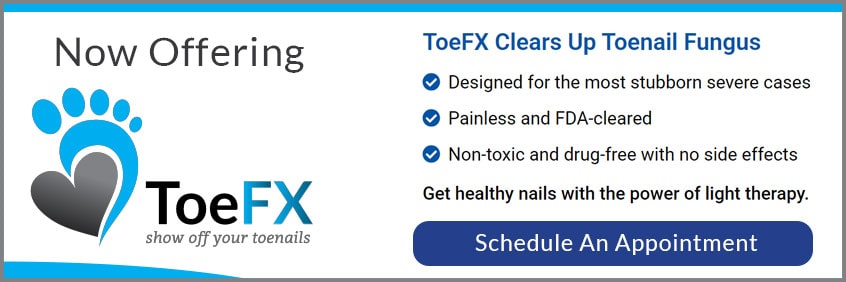 toeFX