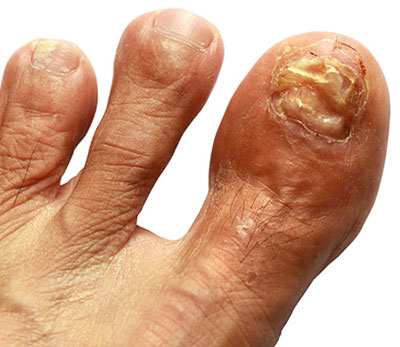 nail