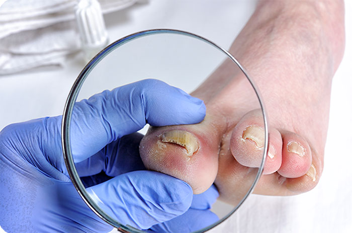 nails under zoom