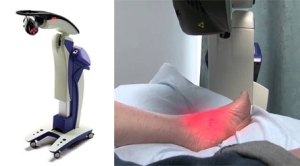 What is Laser Therapy?