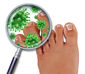 Athlete&#039;s Foot Affects Different Types of People